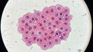 Natural blood sugar support ingredients review