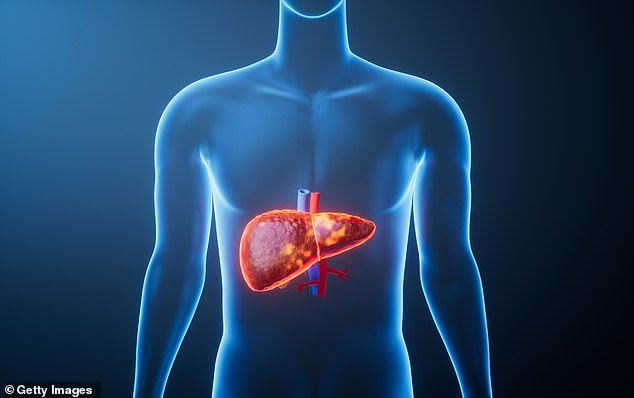 Liver disease breakthrough: NHS data could spot patients at risk YEARS before symptoms – as cases surge among non‑drinkers