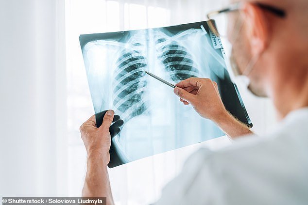 Urgent warning as ‘Victorian’ disease tuberculosis rises in California