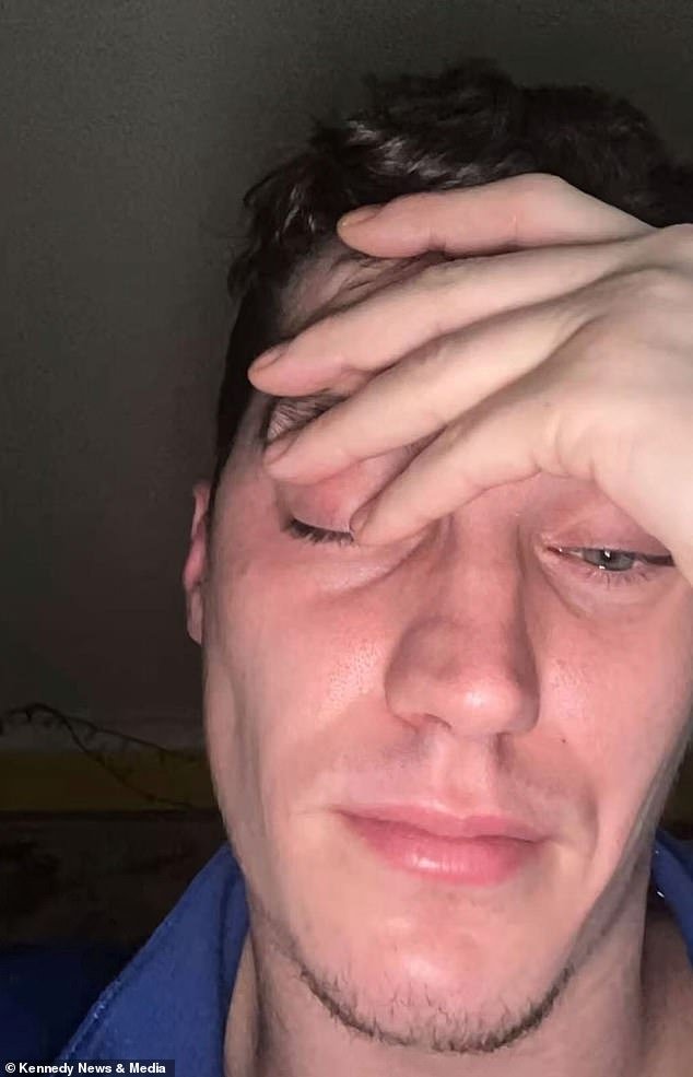 Man, 30, left with ‘collapsed nose’ after snorting more than £35,000-worth of cocaine: ‘I’m disfigured for life… I could have bought a house’